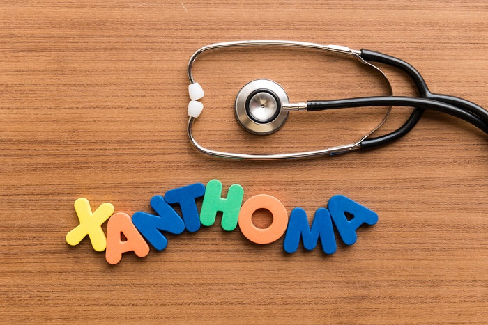 xanthoma removal xanthoma removal 1
